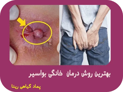 عکس بواسیر،درمان بواسیر