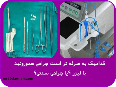 مقایسه جراحی هموروئید با لیزر و سنتی
