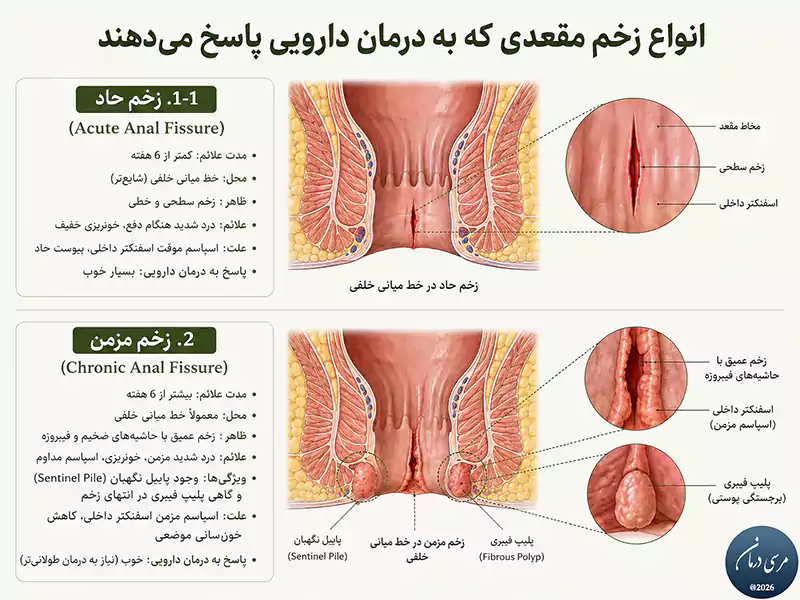 انواع زخم مقعدی که به درمان دارویی پاسخ می‌دهند
