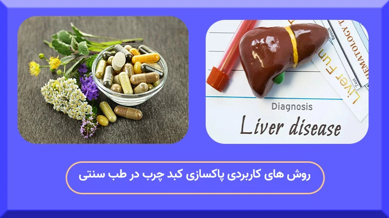 درمان کبد چرب در طب سنتی