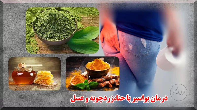 درمان بواسیر با حنا ،زردچوبه و عسل چگونه است