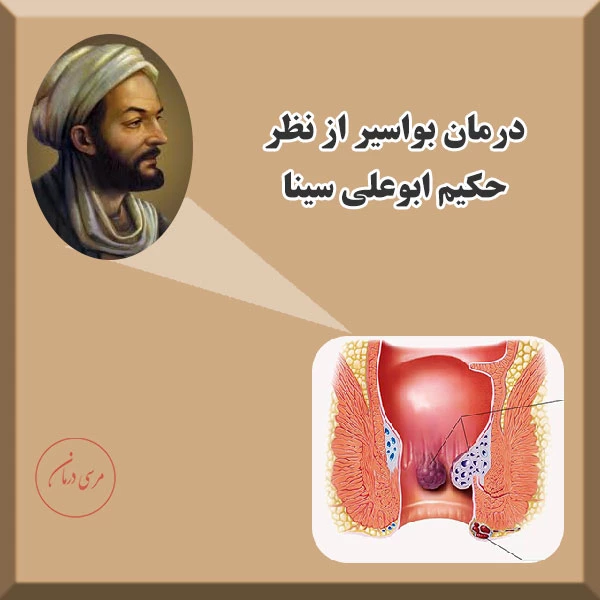 درمان بواسیر در طب بوعلی سینا