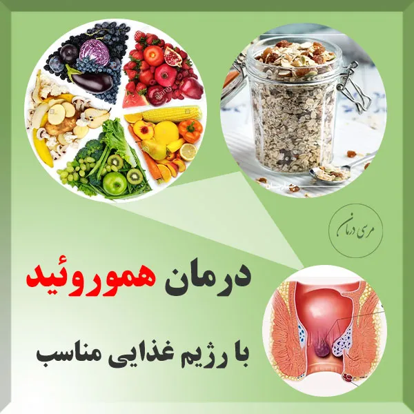 الگوی غذایی مناسب بیماران هموروئیدی