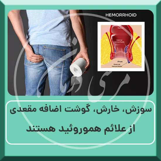 علائم بواسیر