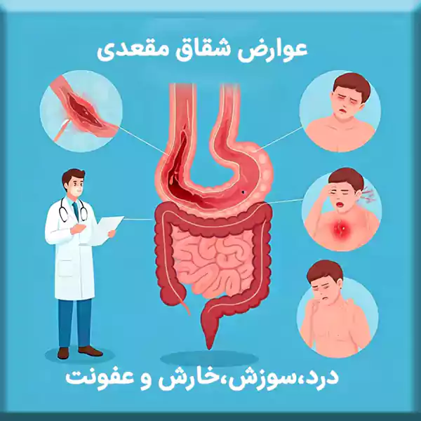 درد سوزش و خارش و خونریزی از عوارض شقاق مقعدی است