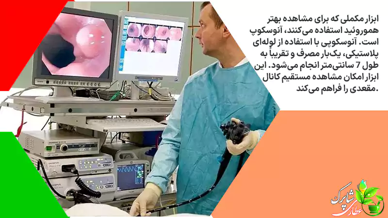 آنوسکوپ است. آنوسکوپی با استفاده از لوله‌ای پلاستیکی، یک‌بار مصرف و تقریباً به طول ۷ سانتی‌متر انجام می‌شود. این ابزار امکان مشاهده مستقیم کانال مقعدی را فراهم می‌کند.