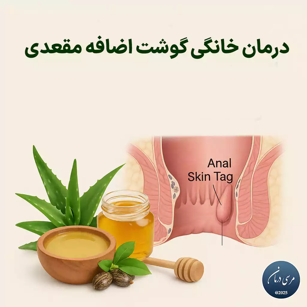 درمان خانگی گوشت اضافه مقعدی در بسیاری از موارد می‌تواند راهی ایمن، کم‌هزینه و طبیعی برای کنترل این عارضه باشد