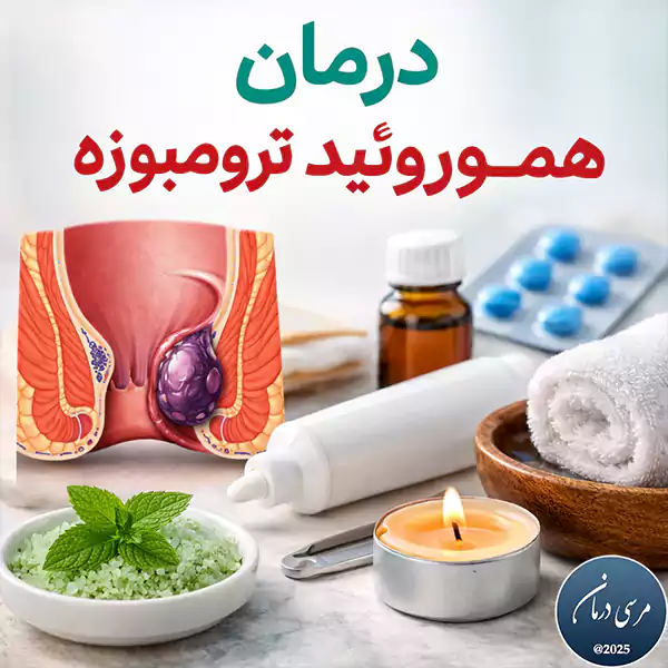 درمان هموروئید ترومبوزه یکی از پرتکرارترین دغدغه‌های بیماران مبتلا به درد ناگهانی و شدید ناحیه مقعد است.